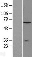 CNOT4 Human Over-expression Lysates NM_001008225
