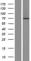 CNOT4 Human Over-expression Lysates NM_001190848