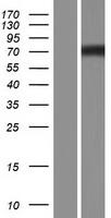 ls004867 nephronophthisis nphp1 human over expression lysates nm 001128179 wb testing 2