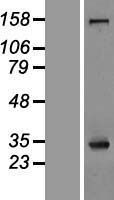 Nucleophosmin (NPM1) Human Over-expression Lysates NM_001037738