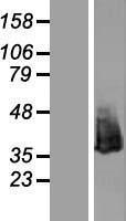 Nucleophosmin (NPM1) Human Over-expression Lysates NM_002520
