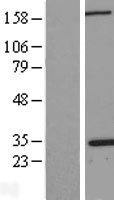 Nucleophosmin (NPM1) Human Over-expression Lysates NM_199185