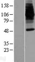 ls004891 dmt1 slc11a2 human over expression lysates nm 000617 wb testing 2