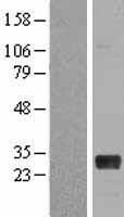 NRL Human Over-expression Lysates NM_006177