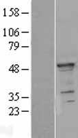 YB1 (YBX1) Human Over-expression Lysates NM_004559