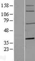 CD73 (NT5E) Human Over-expression Lysates NM_002526