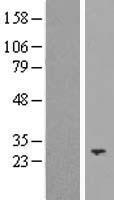 Neurotrophin 3 (NTF3) Human Over-expression Lysates NM_002527