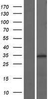NTH1 (NTHL1) Human Over-expression Lysates NM_002528