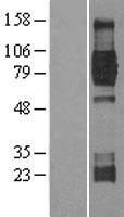 TrkB (NTRK2) Human Over-expression Lysates NM_001007097