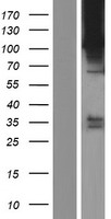 ls004920 ror2 human over expression lysates nm 004560 wb testing 1