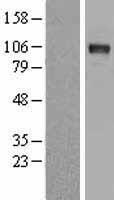 DDR2 Human Over-expression Lysates NM_001014796