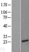 Neurotensin (NTS) Human Over-expression Lysates NM_006183