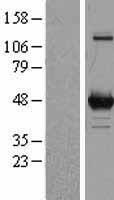 ornithine aminotransferase (OAT) Human Over-expression Lysates NM_000274
