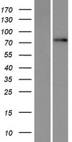 ls004943 tbc1d25 human over expression lysates nm 002536 wb testing 1