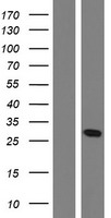 OAZ1 Human Over-expression Lysates NM_004152