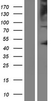 ls004948 p protein oca2 human over expression lysates nm 000275 wb testing 1