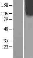 INPP5F (OCRL) Human Over-expression Lysates NM_000276