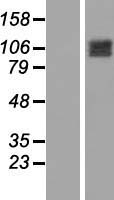 INPP5F (OCRL) Human Over-expression Lysates NM_001587