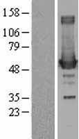 Ornithine Decarboxylase (ODC1) Human Over-expression Lysates NM_002539