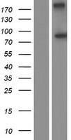 ls004957 odf2 human over expression lysates nm 153436 wb testing 1