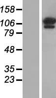 OGDH Human Over-expression Lysates NM_002541