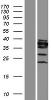 OGG1 Human Over-expression Lysates NM_016819