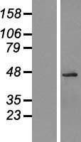 OGG1 Human Over-expression Lysates NM_016821