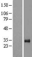 LOX 1 (OLR1) Human Over-expression Lysates NM_002543