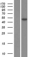 Osteoprotegerin (TNFRSF11B) Human Over-expression Lysates NM_002546