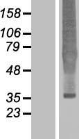 Delta Opioid Receptor (OPRD1) Human Over-expression Lysates NM_000911