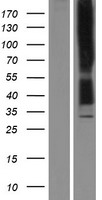 Kappa Opioid Receptor (OPRK1) Human Over-expression Lysates NM_000912