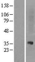 Nociceptin receptor (OPRL1) Human Over-expression Lysates NM_000913