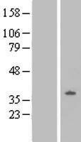 Nociceptin receptor (OPRL1) Human Over-expression Lysates NM_182647