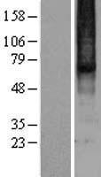 ls004988 mu opioid receptor oprm1 human over expression lysates nm 000914 wb testing 2