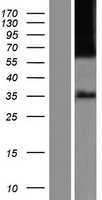 ls004988 mu opioid receptor oprm1 human over expression lysates nm 001145281 wb testing 5