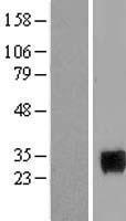 ls004990 homeobox protein six6 six6 human over expression lysates nm 007374 wb testing 1