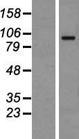ORC1 Human Over-expression Lysates NM_004153