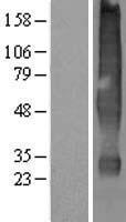 Solute carrier family 22 member 18 (SLC22A18) Human Over-expression Lysates NM_002555