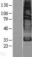 Solute carrier family 22 member 18 (SLC22A18) Human Over-expression Lysates NM_183233