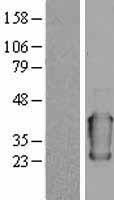 Alpha 1 Acid Glycoprotein (ORM1) Human Over-expression Lysates NM_000607