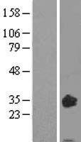 Oncostatin M (OSM) Human Over-expression Lysates NM_020530