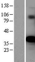 Ornithine Carbamoyltransferase (OTC) Human Over-expression Lysates NM_000531