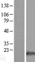 Oligodendrocyte Specific Protein (CLDN11) Human Over-expression Lysates NM_005602