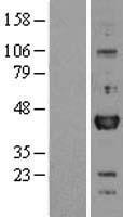 OTX1 Human Over-expression Lysates NM_014562