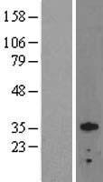OTX2 Human Over-expression Lysates NM_021728