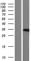 OTX2 Human Over-expression Lysates NM_172337