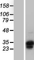 OVOL1 Human Over-expression Lysates NM_004561
