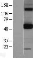 OXCT1 Human Over-expression Lysates NM_000436