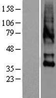 Oxytocin Receptor (OXTR) Human Over-expression Lysates NM_000916