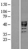 P2X3 (P2RX3) Human Over-expression Lysates NM_002559